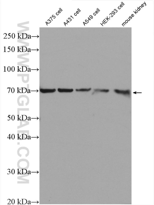 GSDMC Antibody in Western Blot (WB)