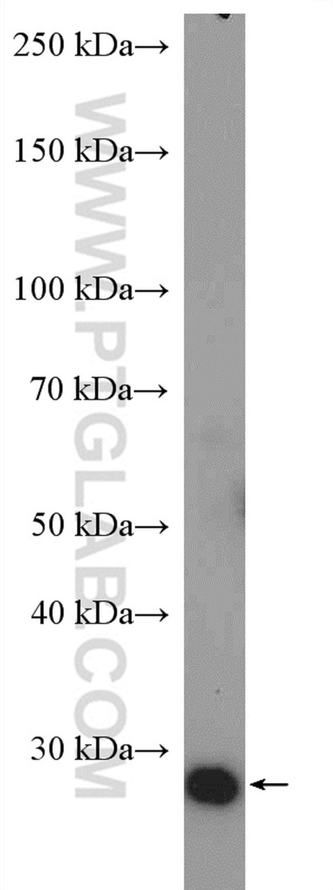 KDELR3 Antibody in Western Blot (WB)