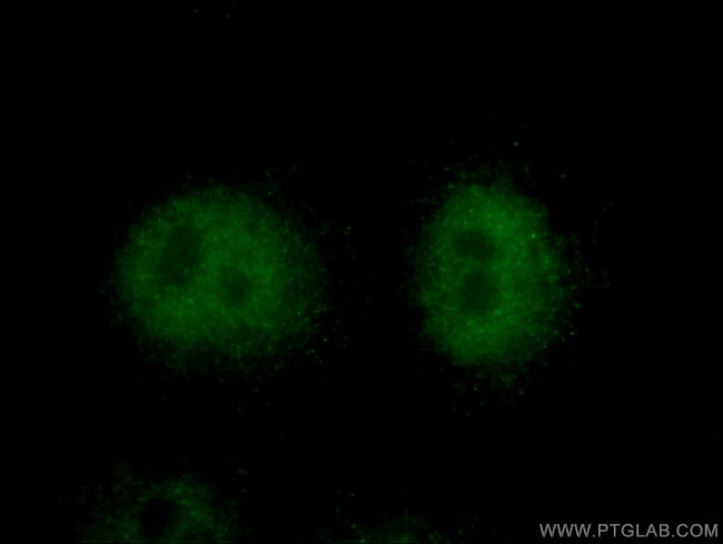 TXNL4A Antibody in Immunocytochemistry (ICC/IF)