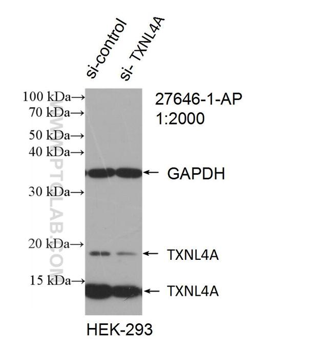 TXNL4A Antibody in Western Blot (WB)