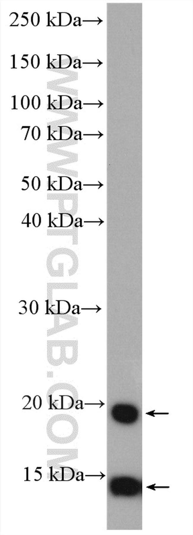 TXNL4A Antibody in Western Blot (WB)