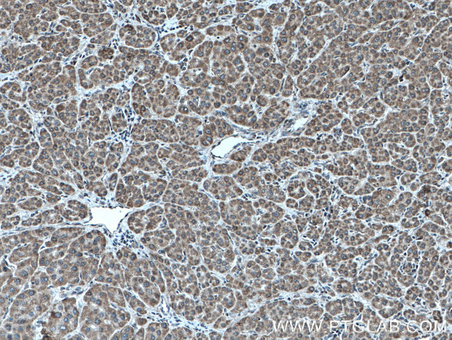 TAPT1 Antibody in Immunohistochemistry (Paraffin) (IHC (P))