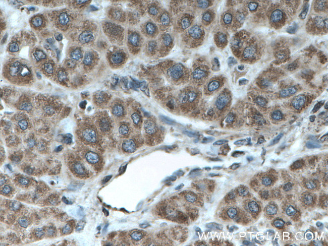 TAPT1 Antibody in Immunohistochemistry (Paraffin) (IHC (P))