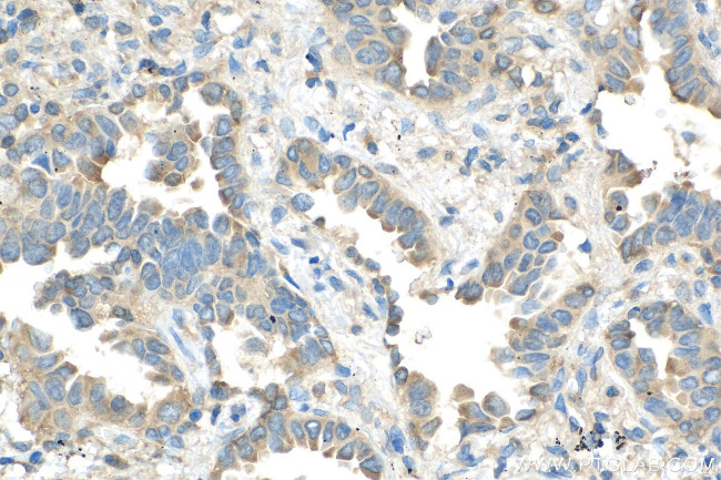 EIF3A Antibody in Immunohistochemistry (Paraffin) (IHC (P))