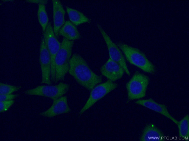 EIF3A Antibody in Immunocytochemistry (ICC/IF)