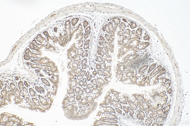 RSL1D1 Antibody in Immunohistochemistry (Paraffin) (IHC (P))