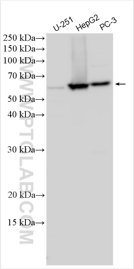 RSL1D1 Antibody in Western Blot (WB)