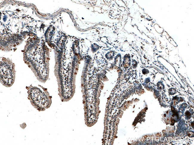 MUC2 Antibody in Immunohistochemistry (Paraffin) (IHC (P))