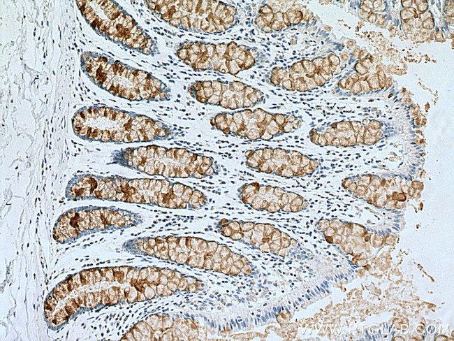 MUC2 Antibody in Immunohistochemistry (Paraffin) (IHC (P))