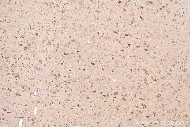 GRIN1 Antibody in Immunohistochemistry (Paraffin) (IHC (P))