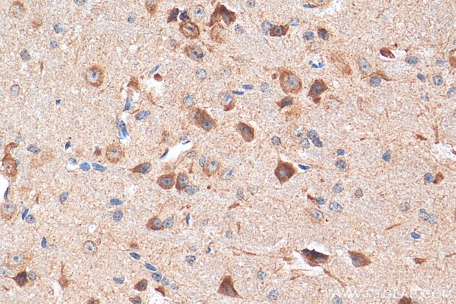 GRIN1 Antibody in Immunohistochemistry (Paraffin) (IHC (P))