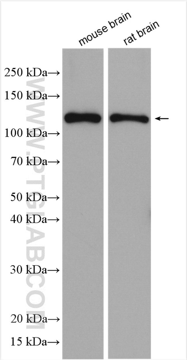 GRIN1 Antibody in Western Blot (WB)