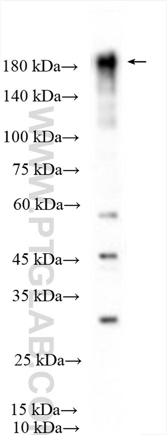 TIAM1 Antibody in Western Blot (WB)