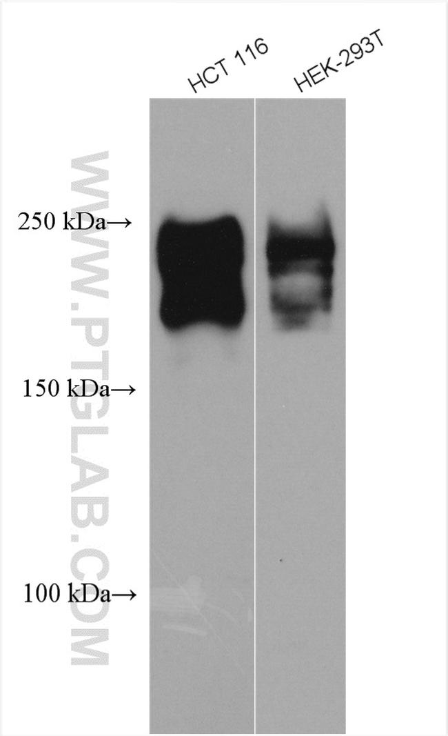 TIAM1 Antibody in Western Blot (WB)