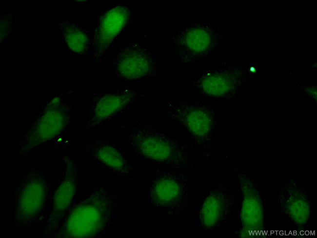 FTSJD2 Antibody in Immunocytochemistry (ICC/IF)