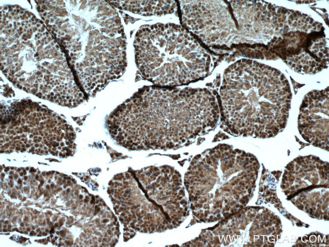 FTSJD2 Antibody in Immunohistochemistry (Paraffin) (IHC (P))