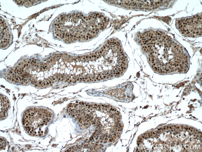 FTSJD2 Antibody in Immunohistochemistry (Paraffin) (IHC (P))