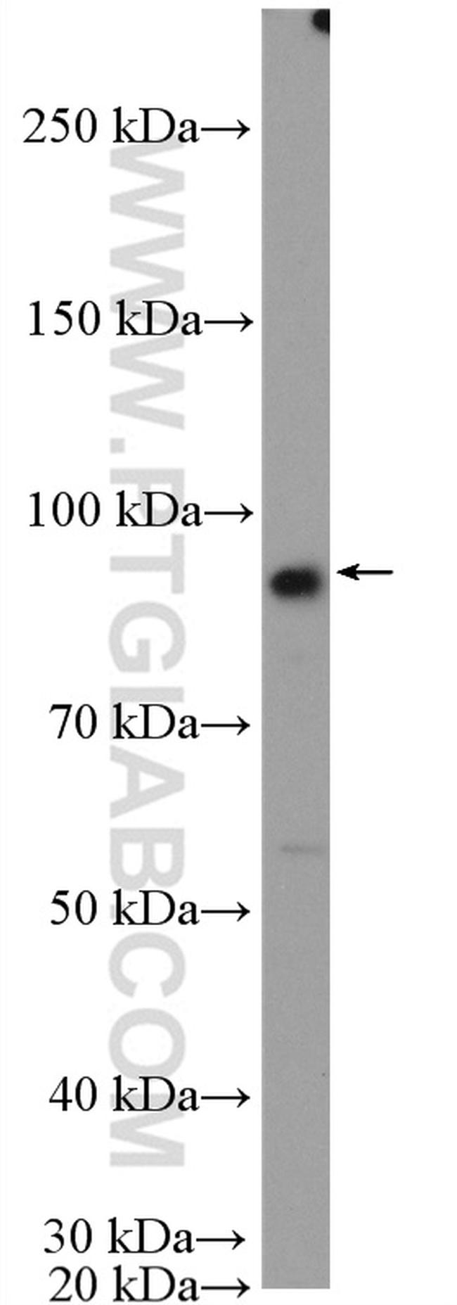 FTSJD2 Antibody in Western Blot (WB)