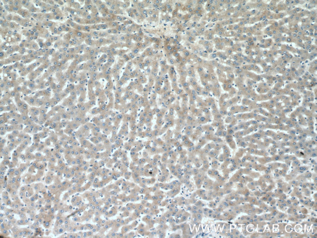 ABCG5 Antibody in Immunohistochemistry (Paraffin) (IHC (P))