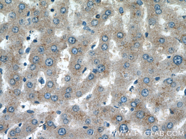 ABCG5 Antibody in Immunohistochemistry (Paraffin) (IHC (P))