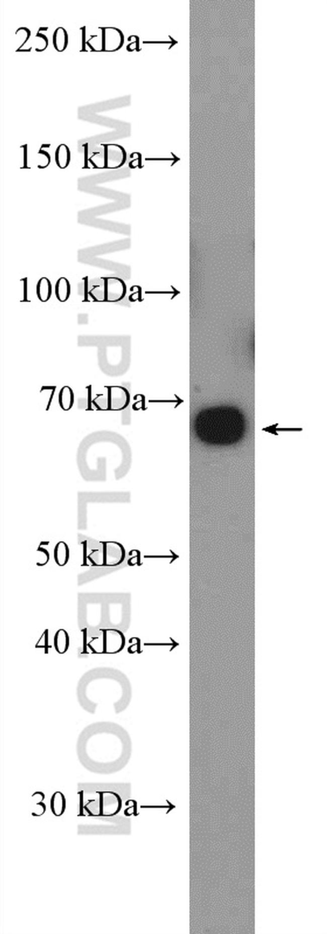 ABCG5 Antibody in Western Blot (WB)