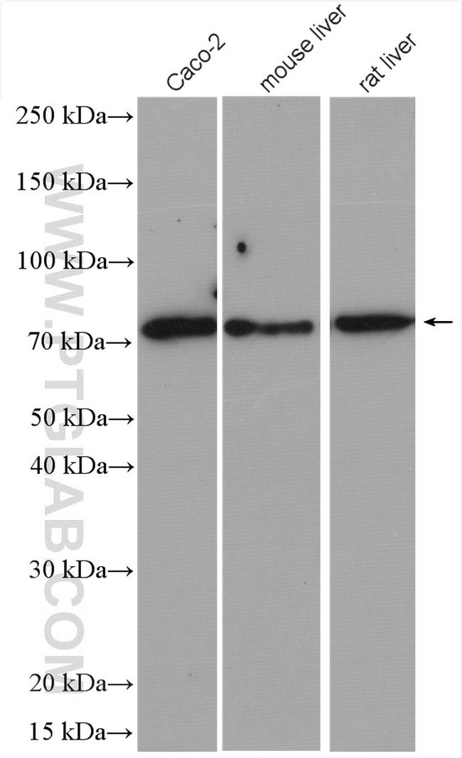 ABCG5 Antibody in Western Blot (WB)