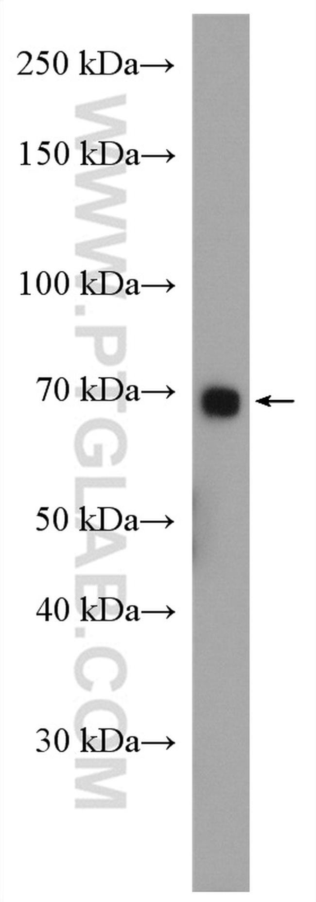 ABCG5 Antibody in Western Blot (WB)