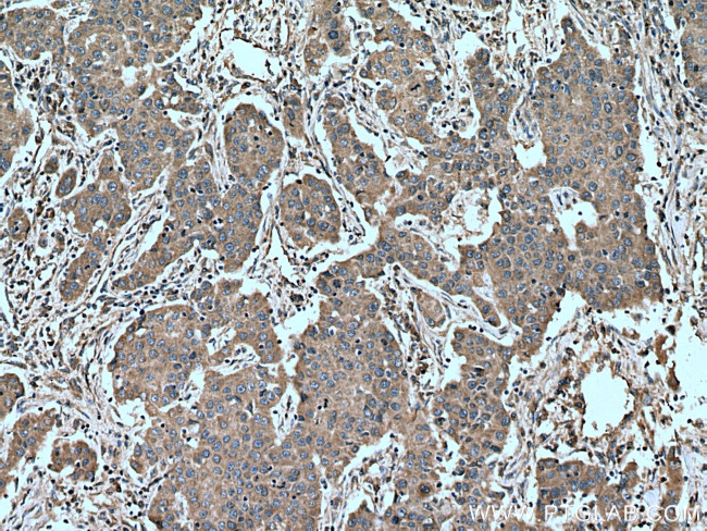 TNFRSF17 Antibody in Immunohistochemistry (Paraffin) (IHC (P))