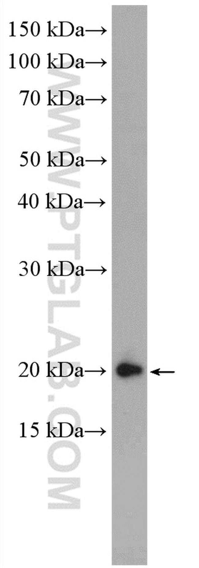 TNFRSF17 Antibody in Western Blot (WB)