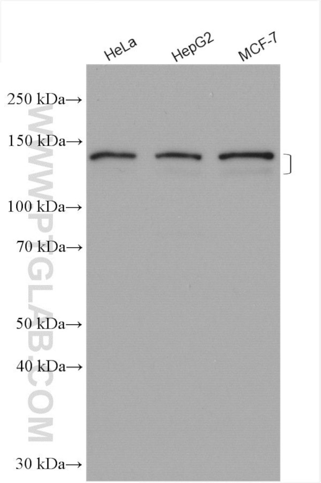 ABCB4 Antibody in Western Blot (WB)