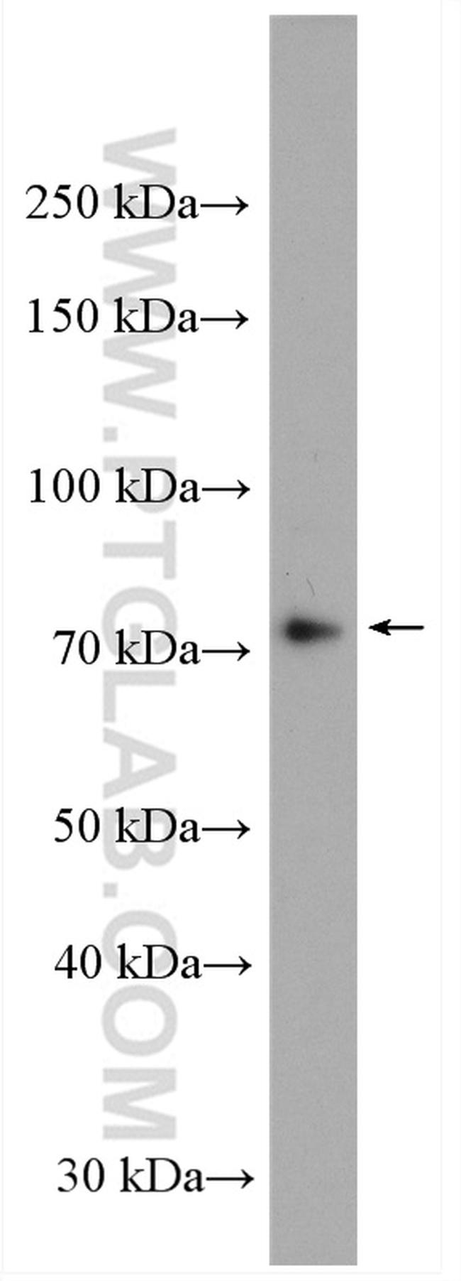 ABI3BP Antibody in Western Blot (WB)