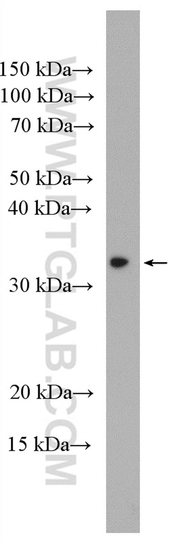 ECHDC1 Antibody in Western Blot (WB)