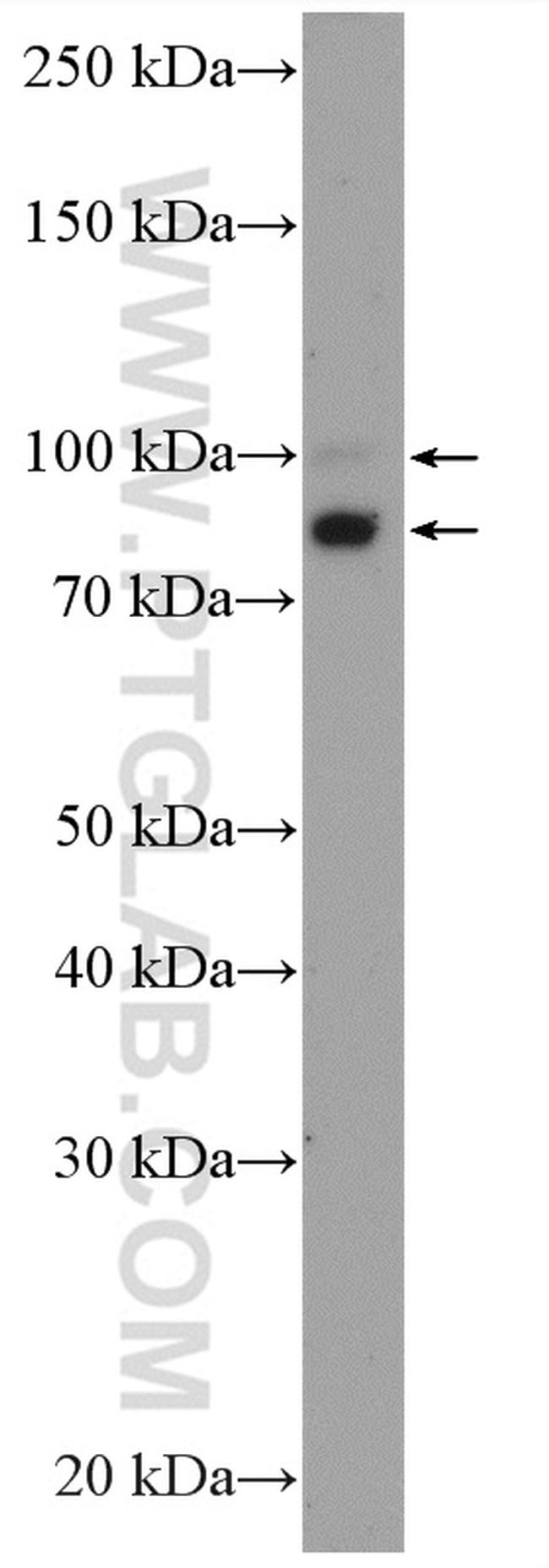 OPA1 Antibody in Western Blot (WB)