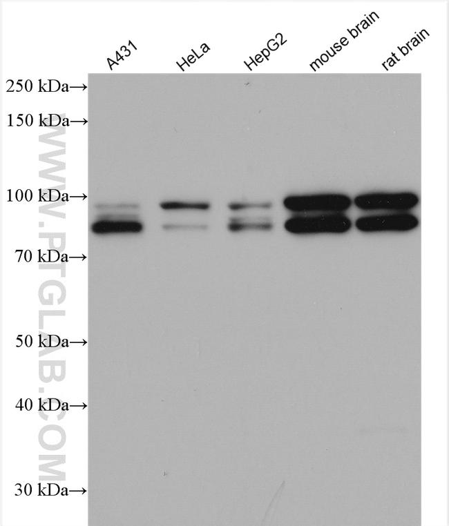 OPA1 Antibody in Western Blot (WB)