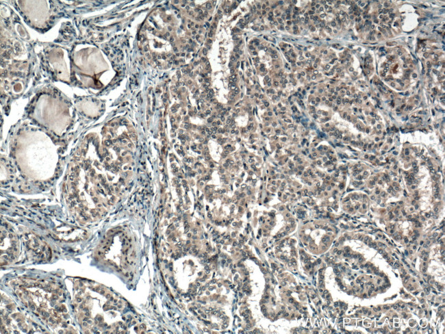 SLC24A5 Antibody in Immunohistochemistry (Paraffin) (IHC (P))