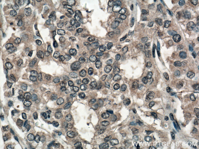 SLC24A5 Antibody in Immunohistochemistry (Paraffin) (IHC (P))