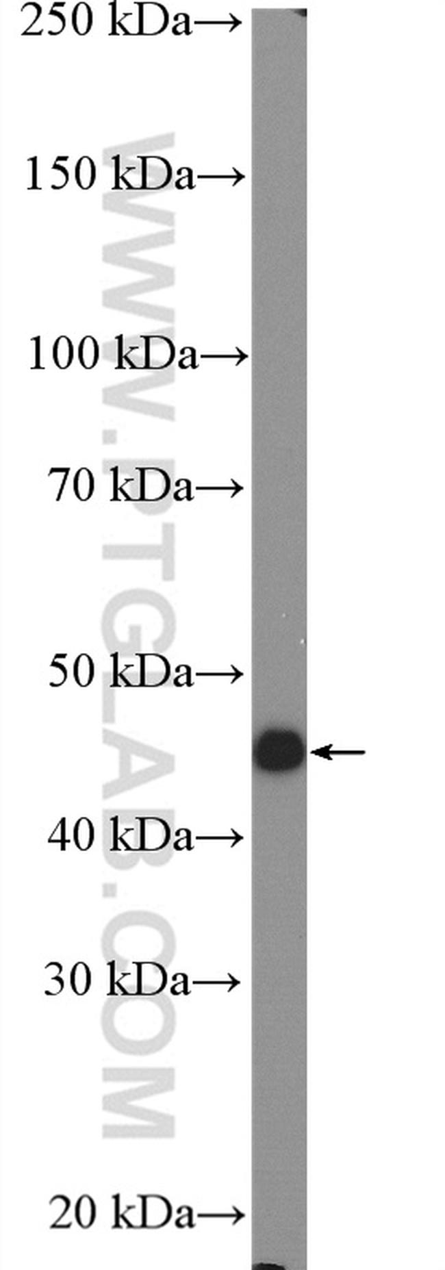 SLC24A5 Antibody in Western Blot (WB)