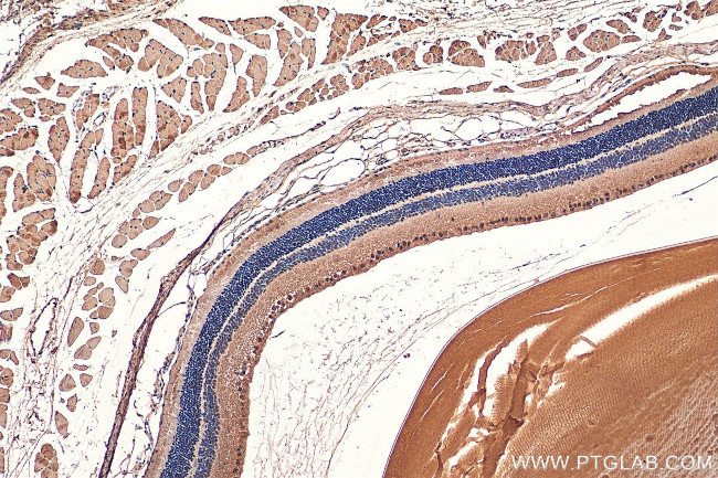 PRPF31 Antibody in Immunohistochemistry (Paraffin) (IHC (P))