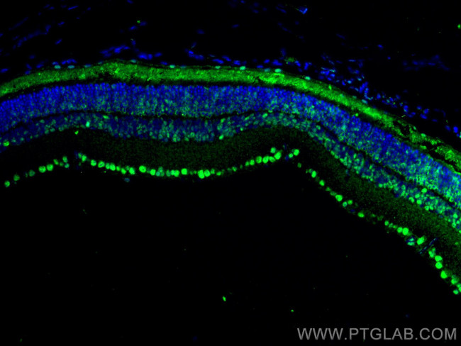 PRPF31 Antibody in Immunohistochemistry (Paraffin) (IHC (P))