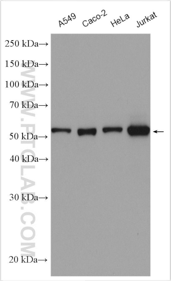 PRPF31 Antibody in Western Blot (WB)