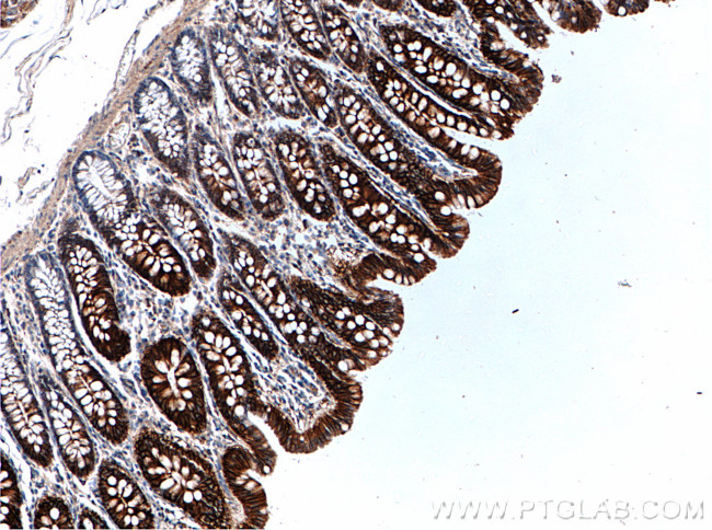 SLC26A2 Antibody in Immunohistochemistry (Paraffin) (IHC (P))