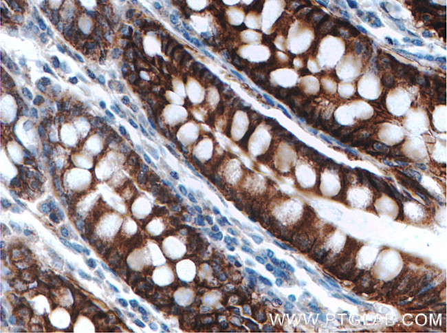 SLC26A2 Antibody in Immunohistochemistry (Paraffin) (IHC (P))