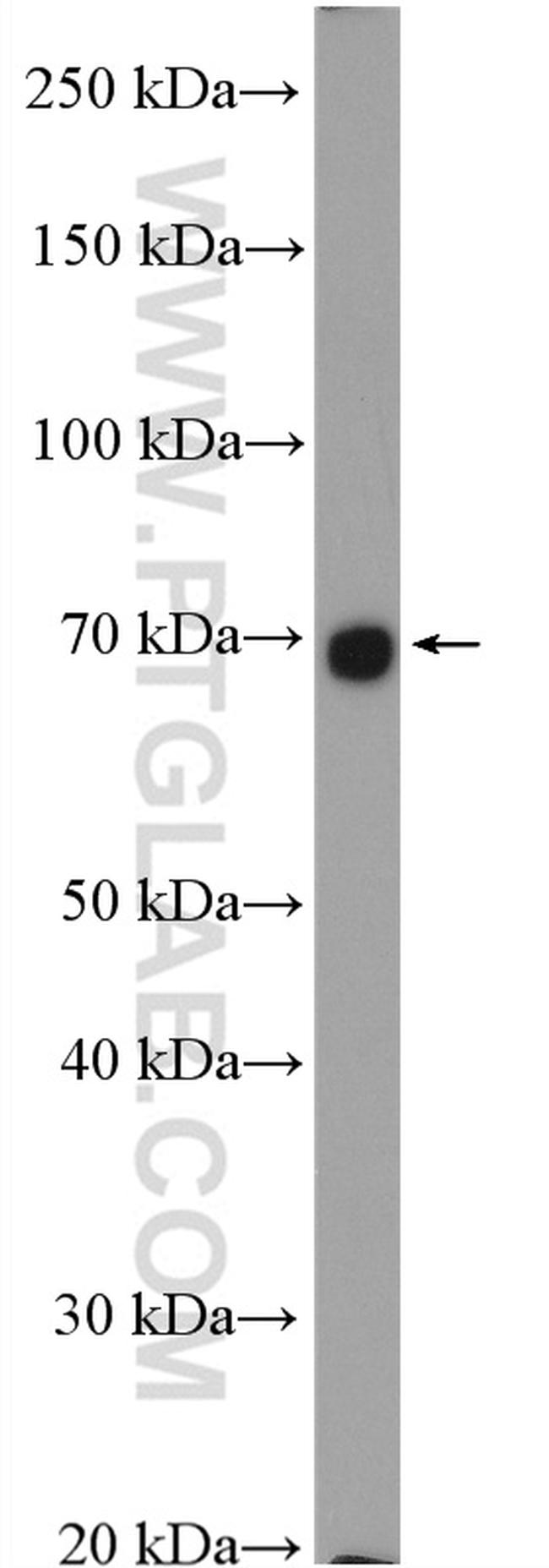 SLC26A2 Antibody in Western Blot (WB)