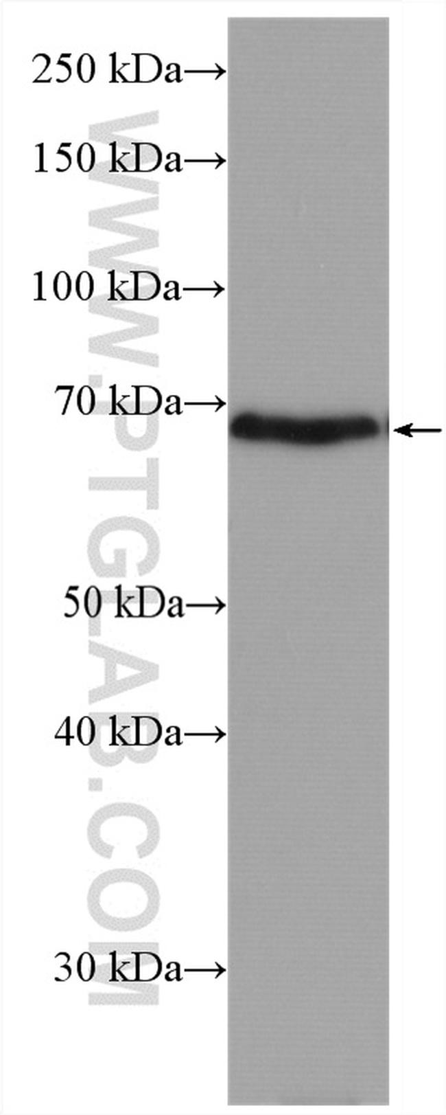 SLC26A2 Antibody in Western Blot (WB)