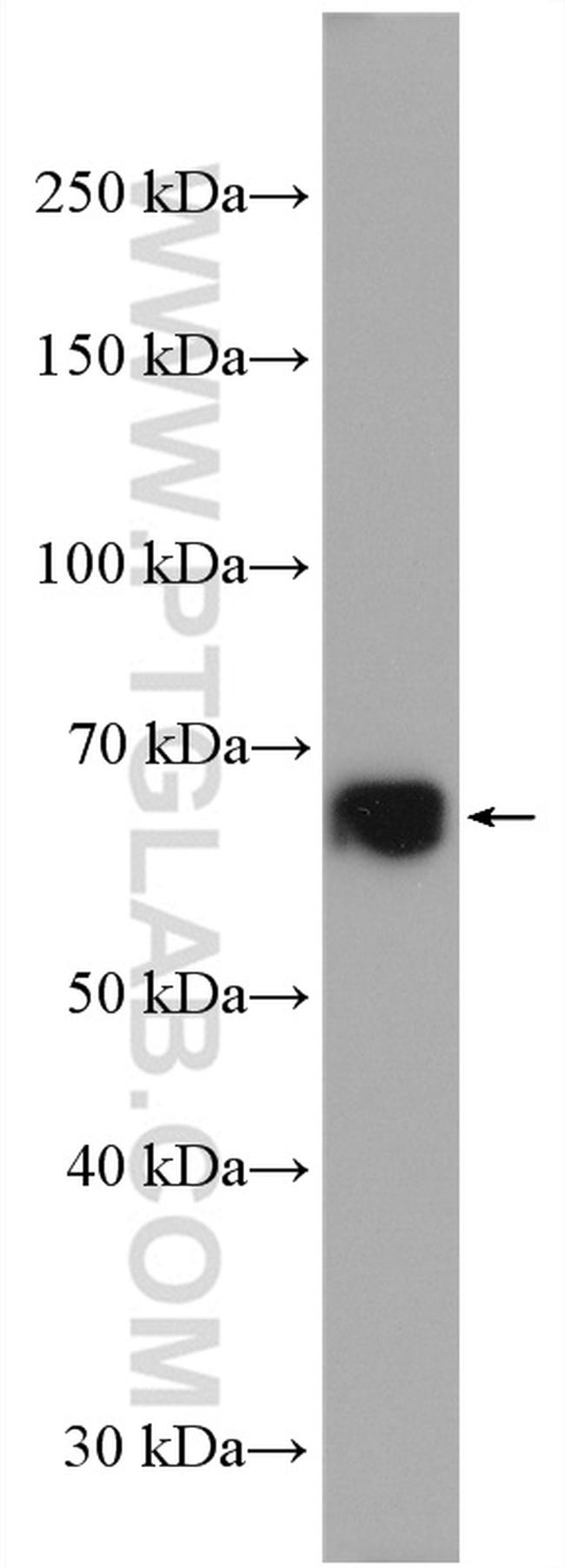 C17orf80 Antibody in Western Blot (WB)