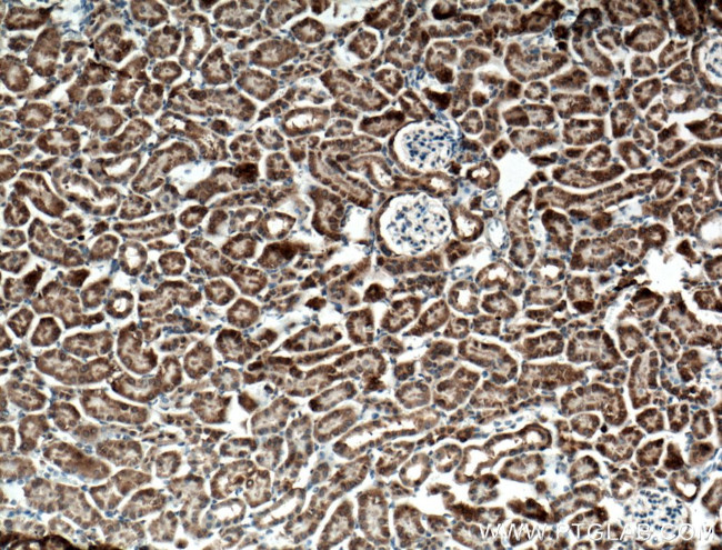 ANK3 Antibody in Immunohistochemistry (Paraffin) (IHC (P))