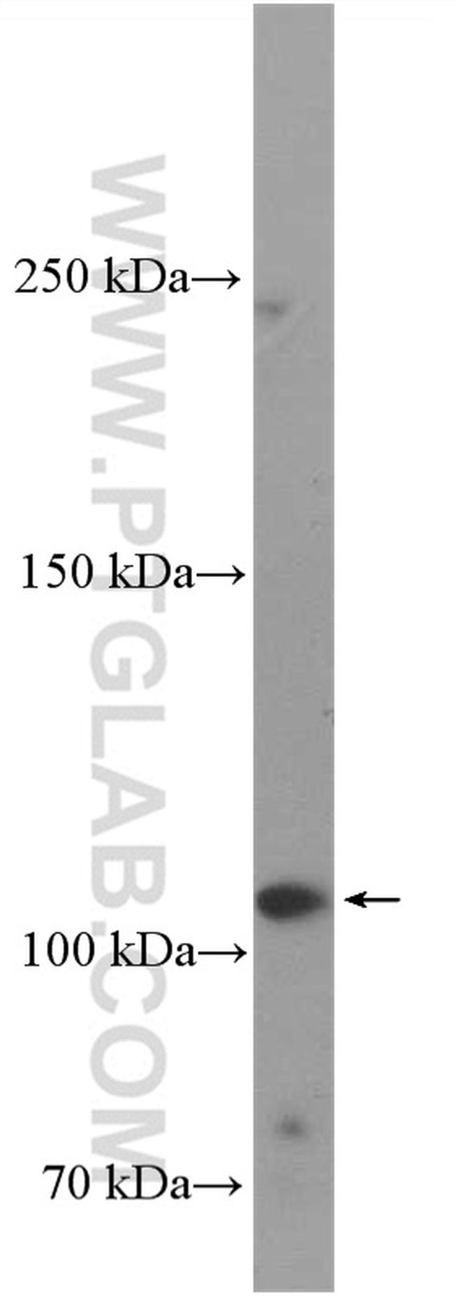 ANK3 Antibody in Western Blot (WB)