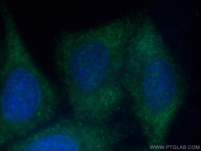 YTHDC2 Antibody in Immunocytochemistry (ICC/IF)