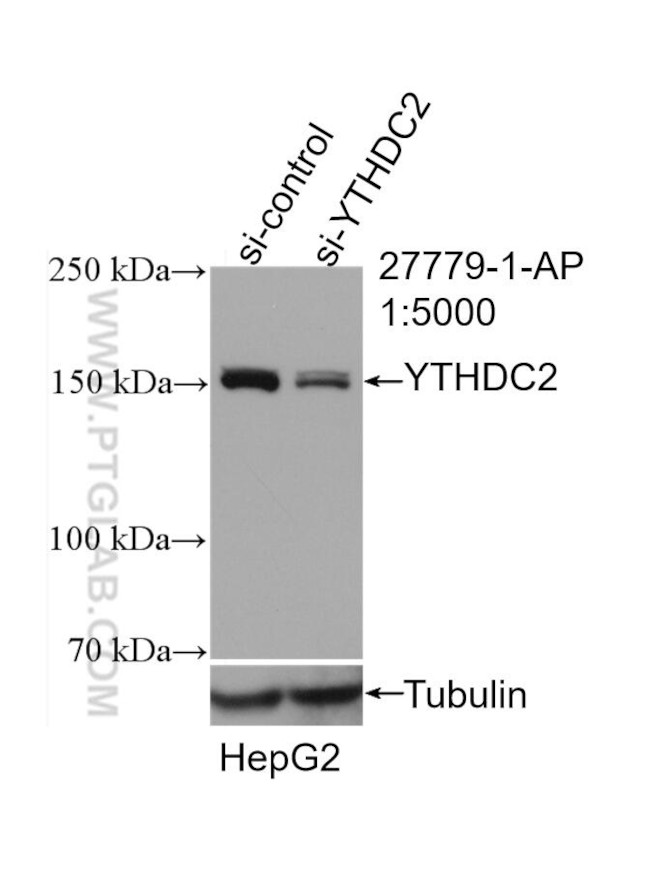 YTHDC2 Antibody in Western Blot (WB)