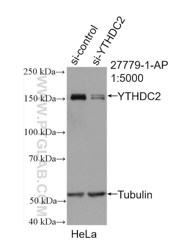 YTHDC2 Antibody in Western Blot (WB)